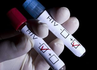 paciente con VIH entra en remisión